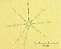 Asterionella formosa