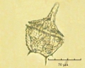 Goniaulax triacantha