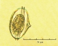 Protoperidinium monacanthus