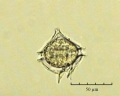Protoperidinium pellucidum