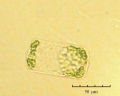 Rhizosolenia fragilissima